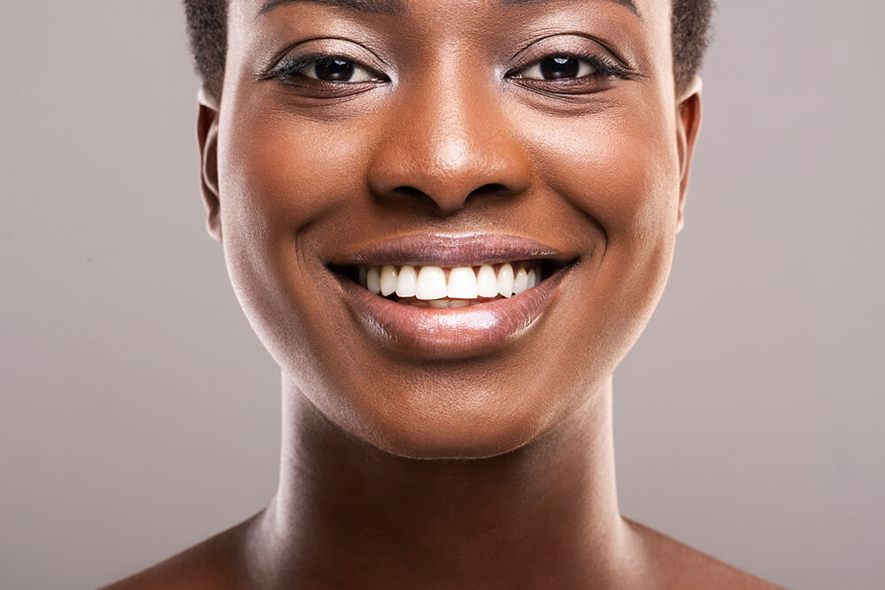 hydrogen peroxide teeth before and after